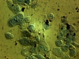 Cells on the polyethersulphone surface (fluorescent microscope)