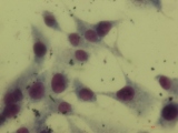 Fibroblasts on PLLA (fluorescent microscope)
